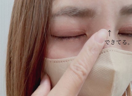 ごめんね素肌 キニナルマスク/クリアターン/シートマスク・パックを使ったクチコミ(7枚目)