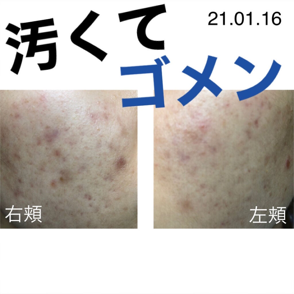 プロポリス エネルギーアンプル/CNP Laboratory/美容液を使ったクチコミ(2枚目)