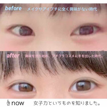 絆創膏/その他を使ったクチコミ(3枚目)