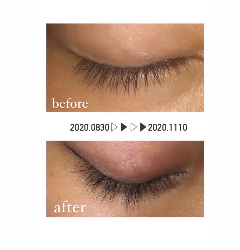 EMAKED（エマーキット）/水橋保寿堂製薬/まつげ美容液を使ったクチコミ（1枚目）