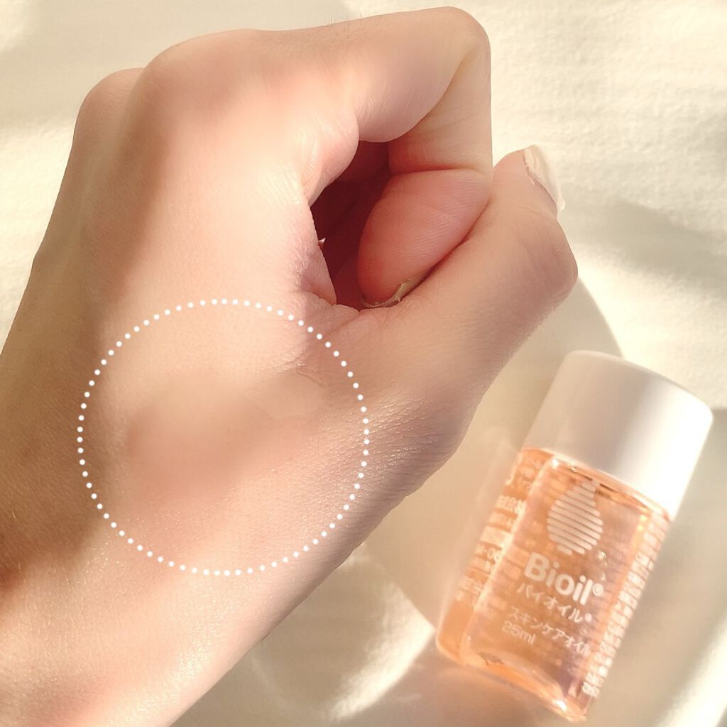 バイオイル/バイオイル/フェイスオイルを使ったクチコミ（3枚目）