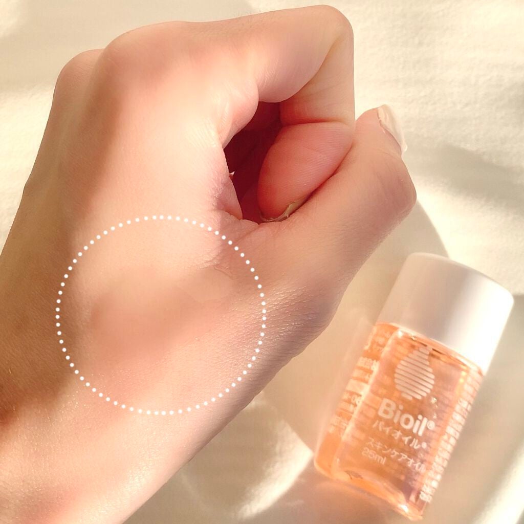 バイオイル/バイオイル/フェイスオイルを使ったクチコミ(3枚目)