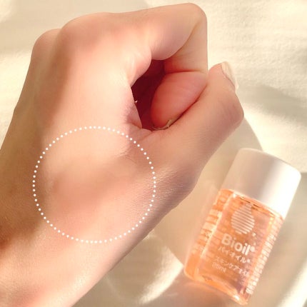 バイオイル/バイオイル/フェイスオイルを使ったクチコミ(3枚目)