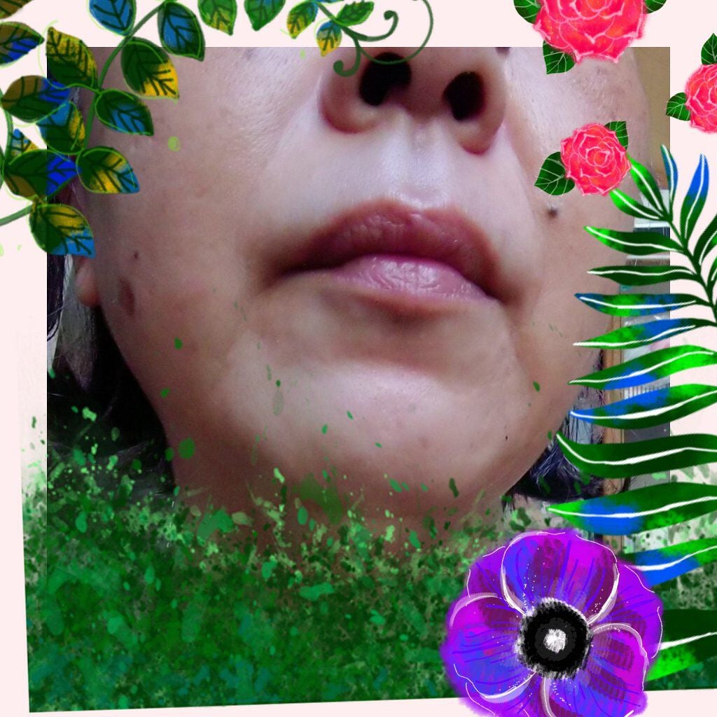 Yukiko @Lipsパートナー on LIPS 「ウォーターピーリングでマッサージほうれい線が薄くなってきたかな..」(2枚目)