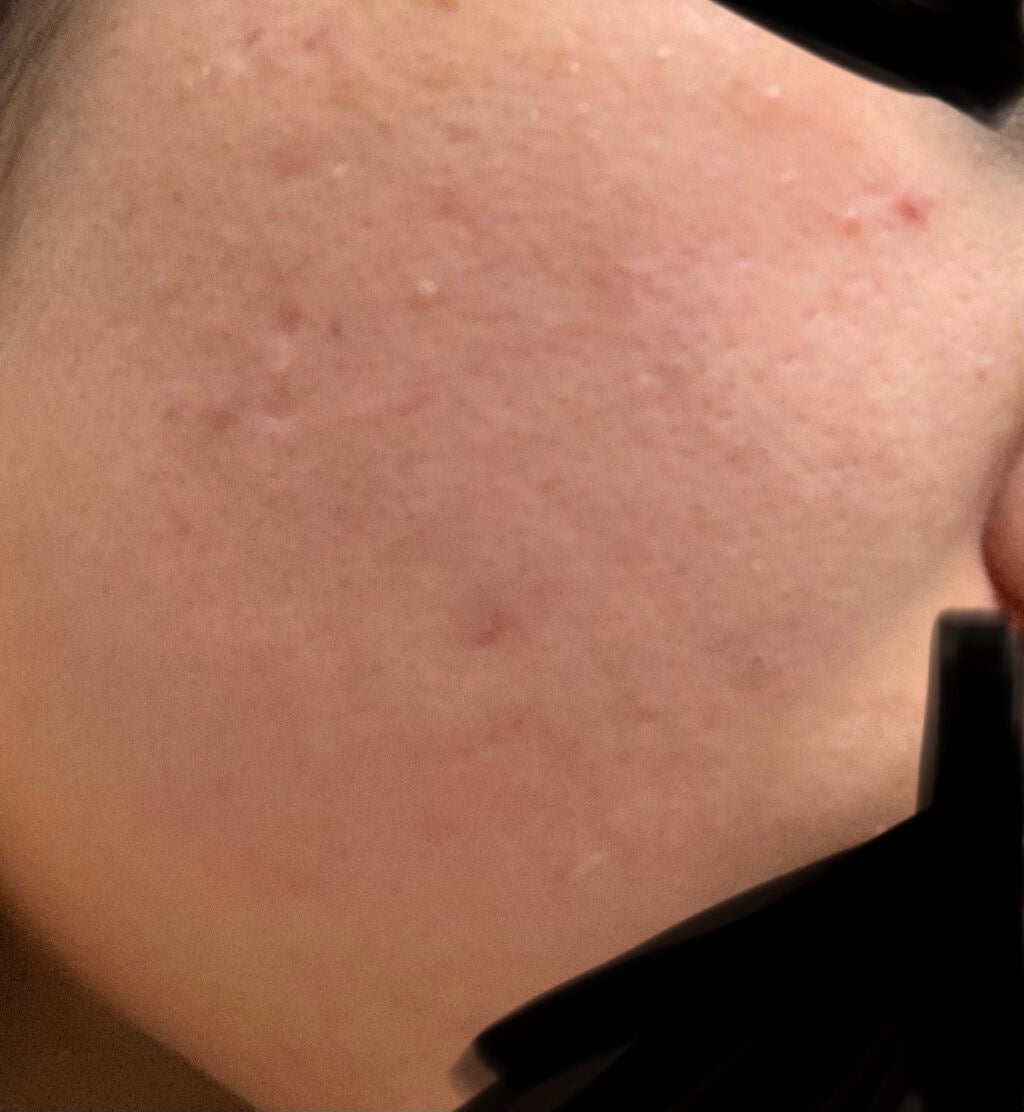 クリアウォッシュ/オルビス/洗顔フォームを使ったクチコミ(3枚目)