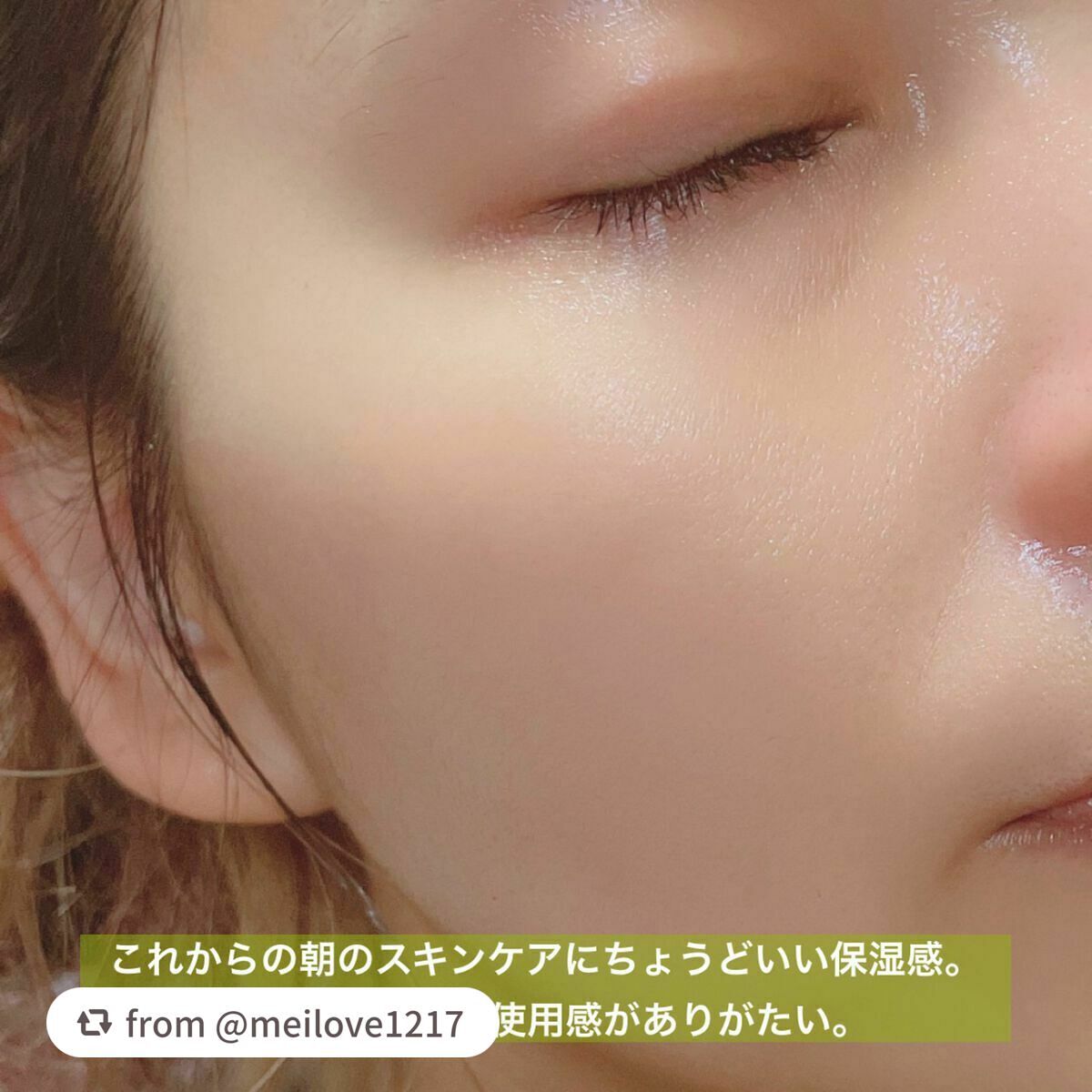 <楽天限定>ドクダミ3種セット/Abib /スキンケアキットを使ったクチコミ(8枚目)