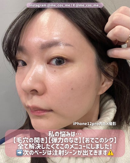 með¥éåœã³ã¹ã¡ç ç©¶å®¶ on LIPS ãéåœã·ã³ãã³ãã§ã³é§
ããã®ãµã³ãã¥ãŒå»é¢ðïžæ°ã«ãªãã·ã¯ãæ¯ç©Ž..ãïŒ4æç®ïŒ