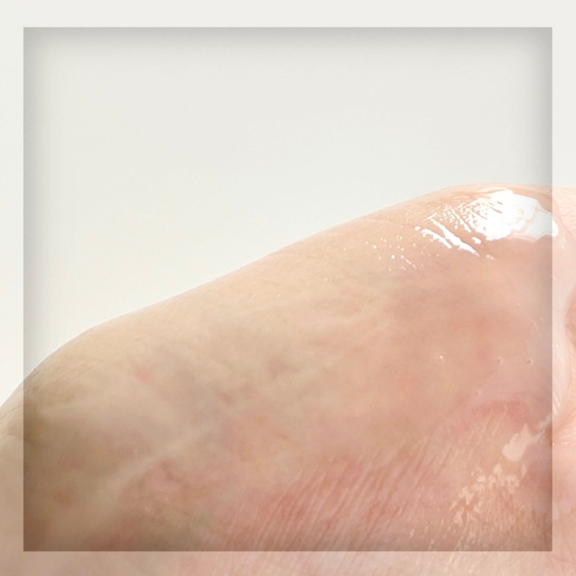 ブレミショット美容液/AMPLE:N/美容液を使ったクチコミ(5枚目)