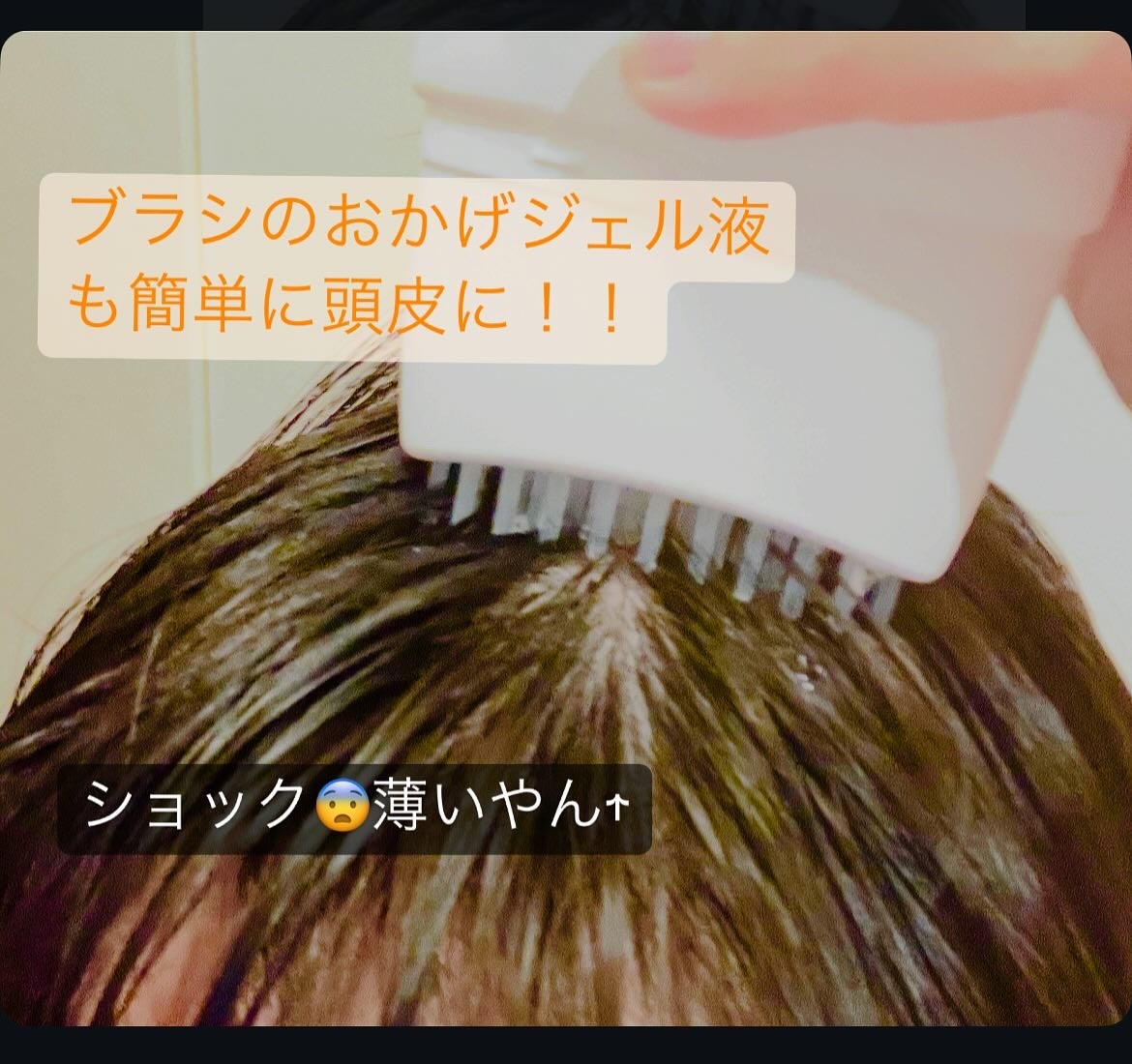 グローターン 100ml/リリーイブ/頭皮ローションを使ったクチコミ(3枚目)