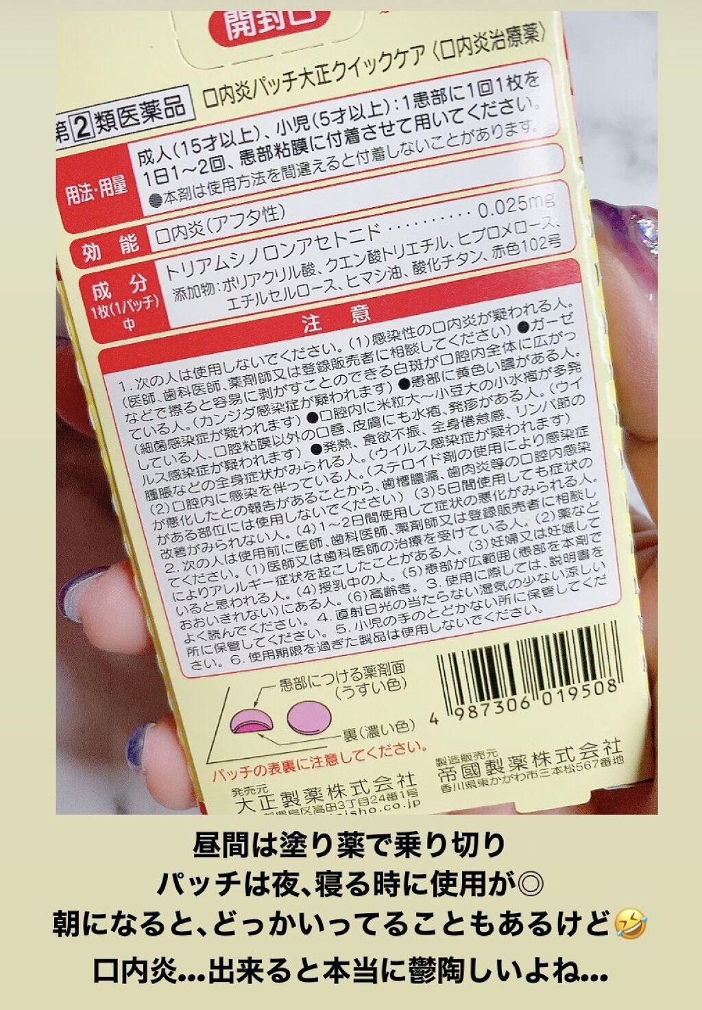 口内炎パッチ大正クイックケア/大正製薬/その他を使ったクチコミ（2枚目）