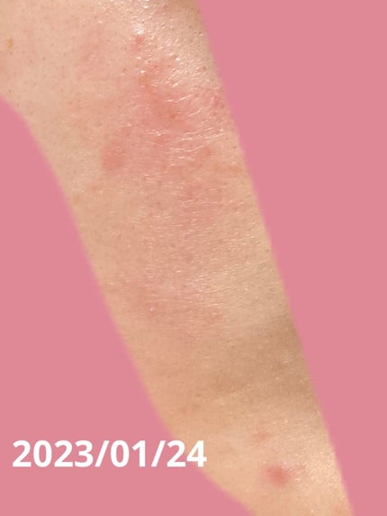 薬用しみ対策 美白化粧水/メラノCC/化粧水を使ったクチコミ(2枚目)