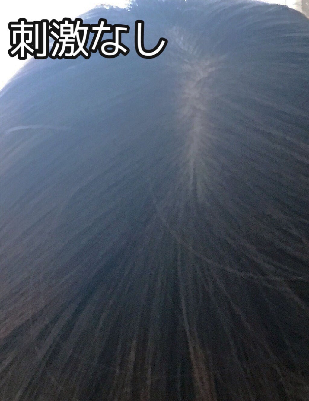 メディカルスカルプスパエッセンス/ティアレラプラス/頭皮ローションを使ったクチコミ(5枚目)