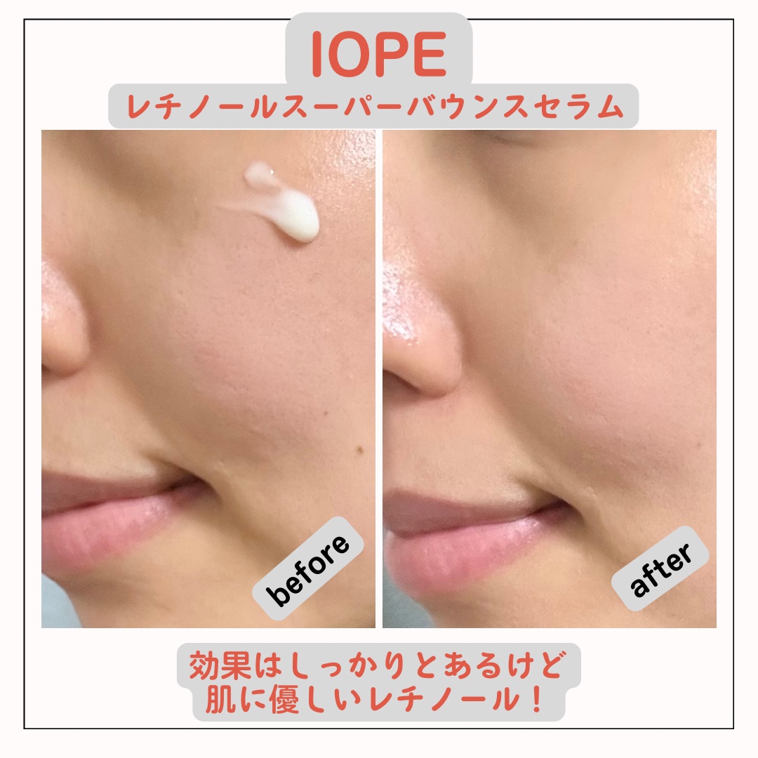 レチノール スーパーバウンス セラム/IOPE/美容液を使ったクチコミ（3枚目）
