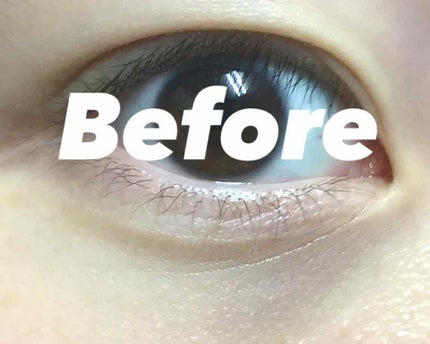 スポッツカバー ファウンデイション/SHISEIDO/クリームコンシーラーを使ったクチコミ(1枚目)