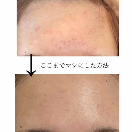 明色美顔水 薬用化粧水/美顔/化粧水を使ったクチコミ(1枚目)