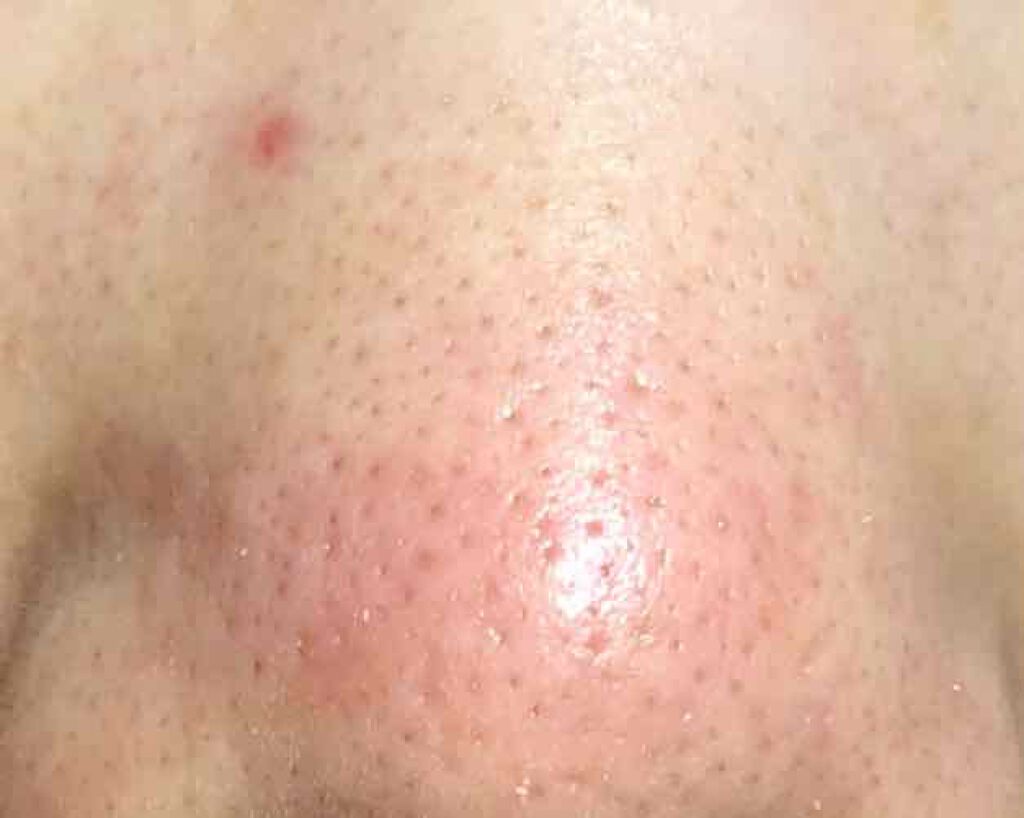 ベビーオイル ナチュラル/DAISO/ボディオイルを使ったクチコミ(2枚目)