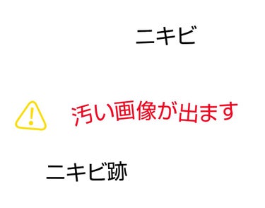 突然ごめんなさい。
私はニキビが最近凄く出来やすくなりました。
ニキビ跡も気になり自分の顔を見るのが嫌になることが増えました。

もしニキビができて治ったって言う経験のある方
オススメの物やどういうこと