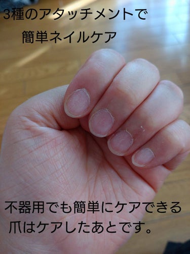 Electric Nail Care Set/セリア/ネイル用品を使ったクチコミ（2枚目）