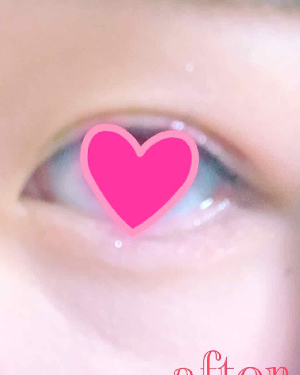 ハイブリッドフィルム/アイトーク/二重まぶた用アイテムを使ったクチコミ(4枚目)