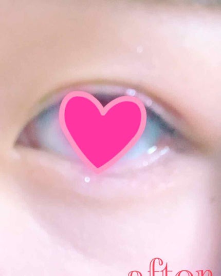 ハイブリッドフィルム/アイトーク/二重まぶた用アイテムを使ったクチコミ(4枚目)