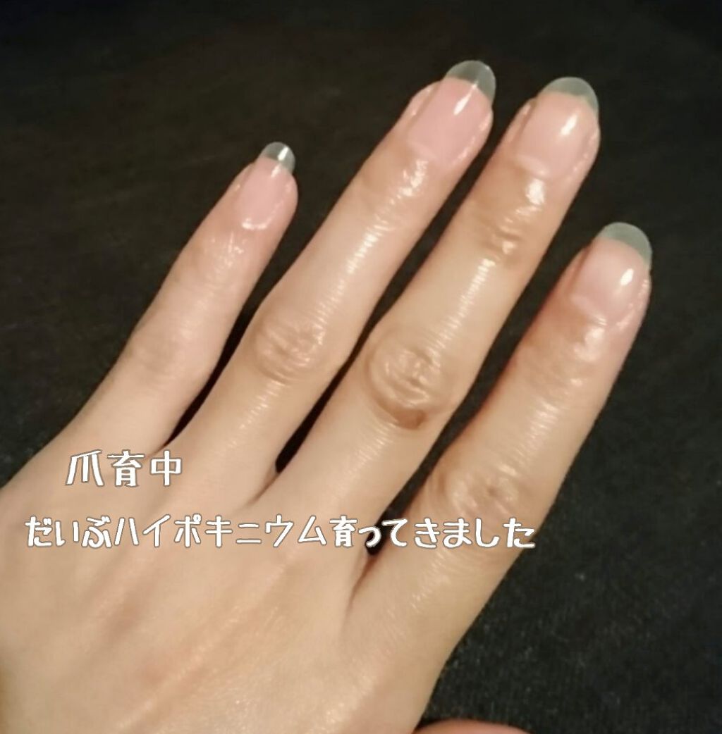 アロマキューティクルオイル/D-UP/ネイルオイル・トリートメントを使ったクチコミ（3枚目）