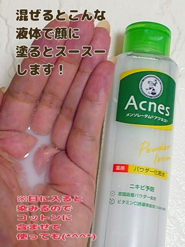 薬用パウダー化粧水/メンソレータム アクネス/化粧水を使ったクチコミ（3枚目）