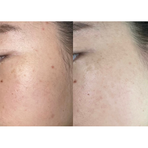 EGFアランテノールクリーム/CELLINSHOT/フェイスクリームを使ったクチコミ（3枚目）