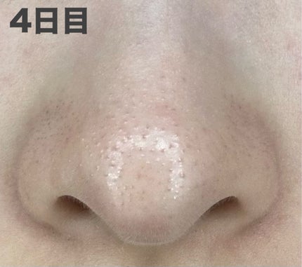 アンドハニー クレンジングバーム ブラック/&honey/クレンジングバームを使ったクチコミ(5枚目)