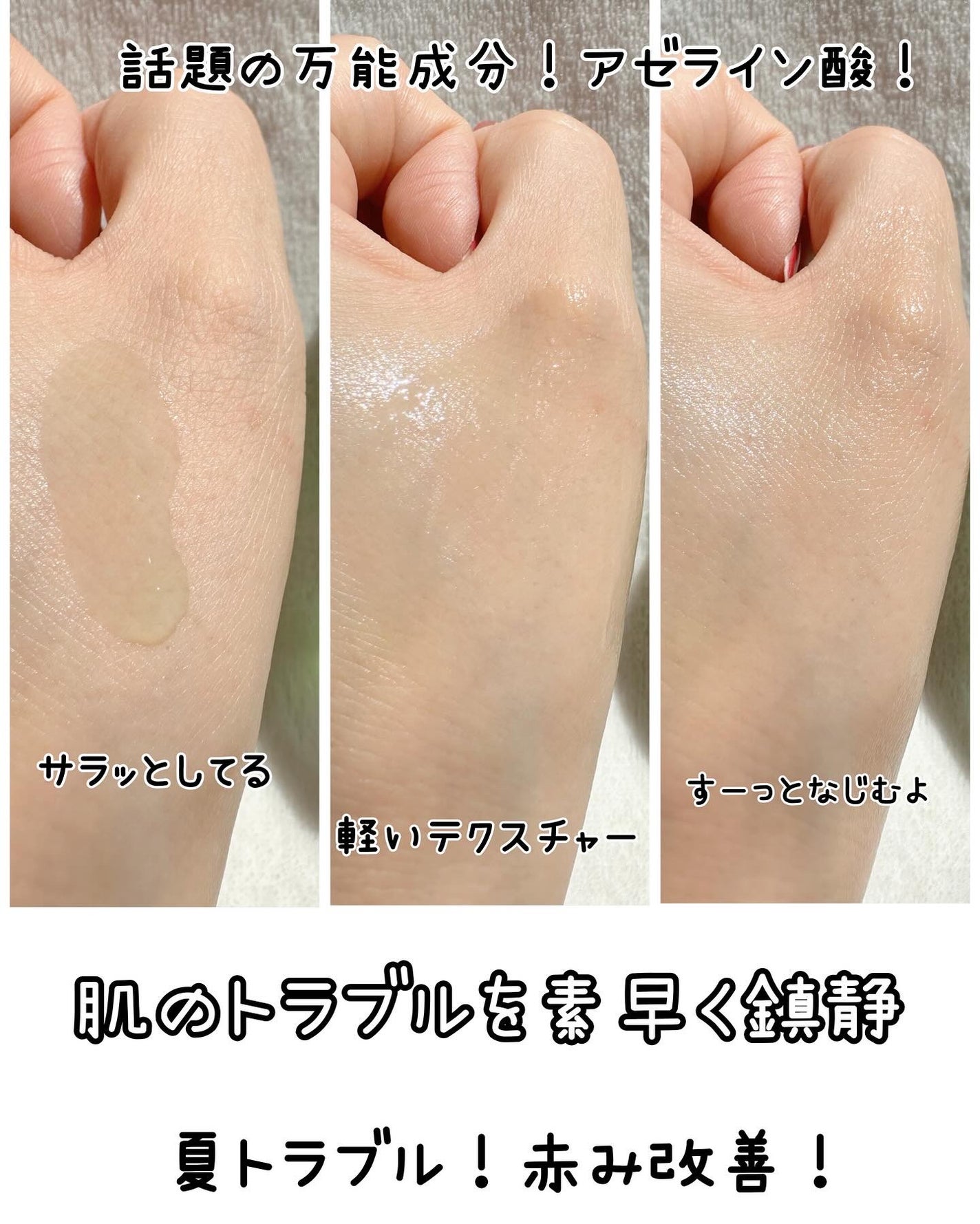 アゼライン酸15 インテンスカーミングセラム/Anua/美容液を使ったクチコミ(6枚目)