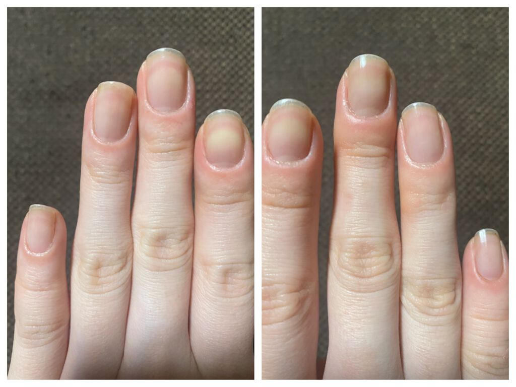 ネイルエンビー/O・P・I/ネイルオイル・トリートメントを使ったクチコミ（3枚目）