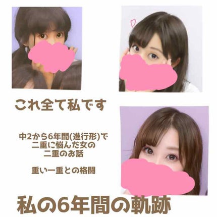 アイトーク クリアジェル/アイトーク/二重まぶた用アイテムを使ったクチコミ(1枚目)