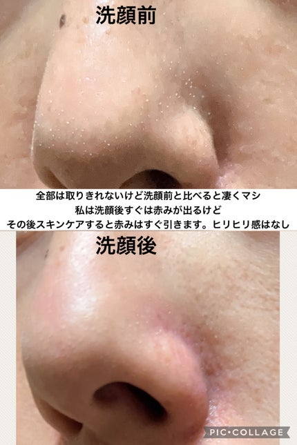 ソフィーナ iP ポア クリアリング ジェル ウォッシュ/SOFINA iP/その他洗顔料を使ったクチコミ(5枚目)