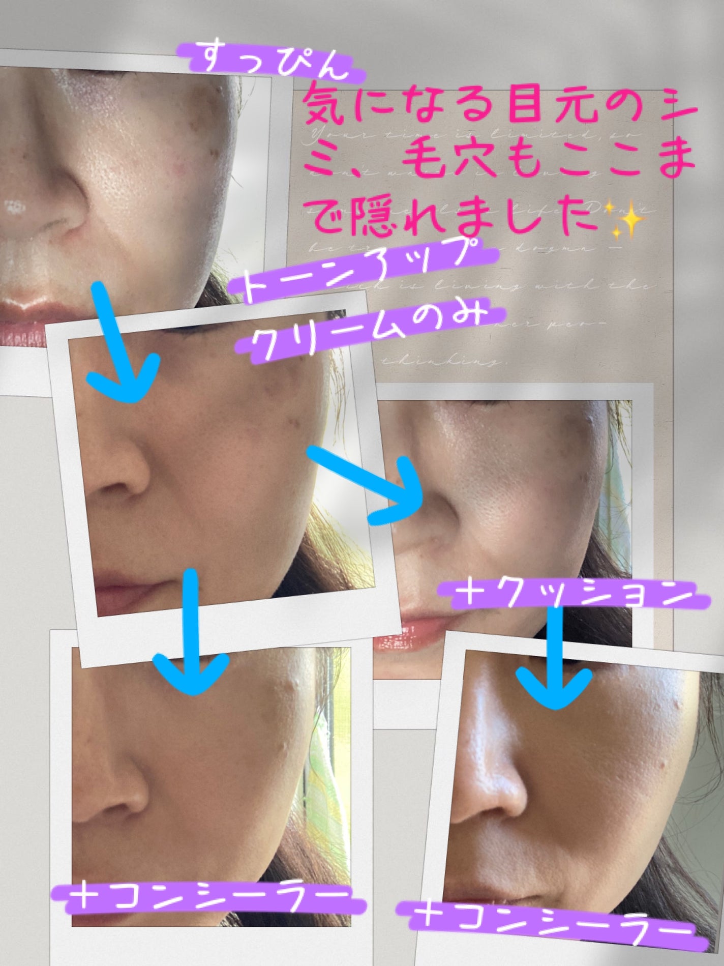 ダーマシンコンシーラー/23years old/リキッドコンシーラーを使ったクチコミ(3枚目)