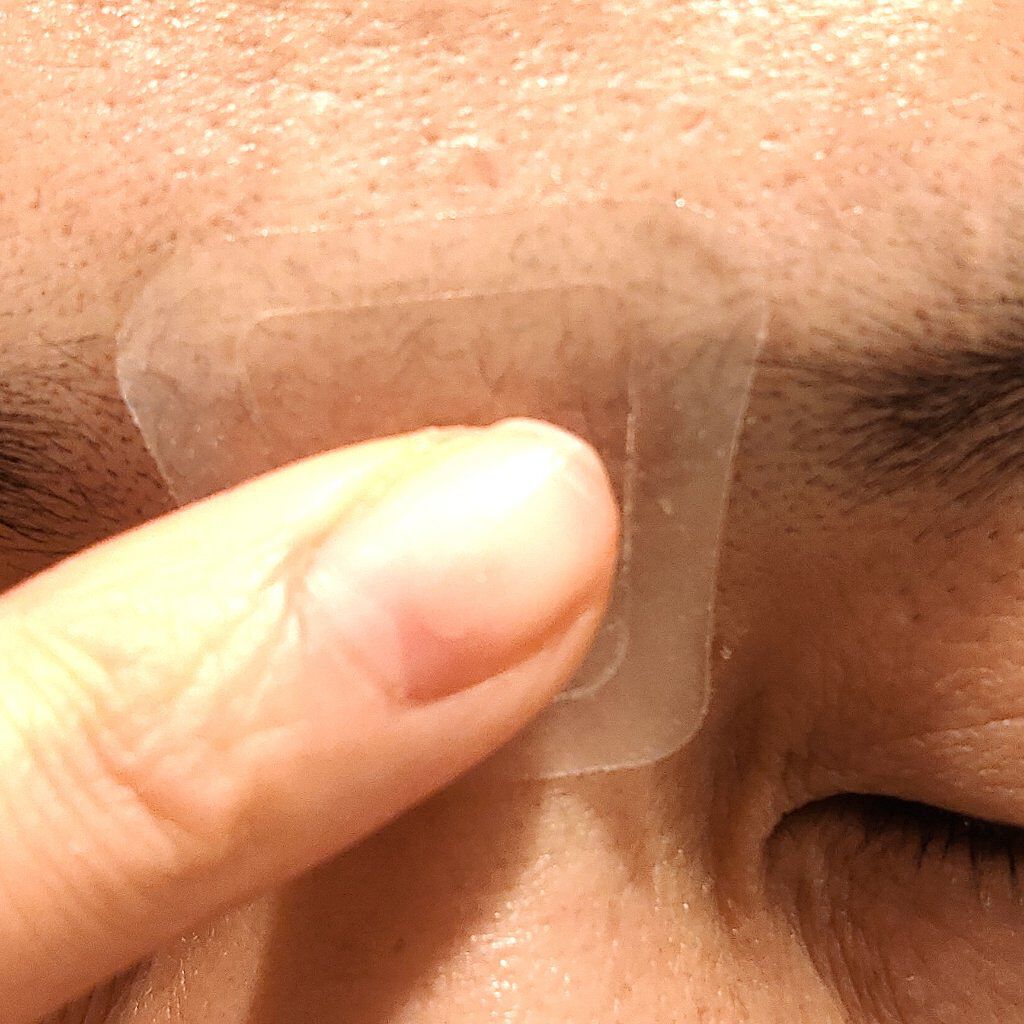 ミケンディープパッチ/北の快適工房/シートマスク・パックを使ったクチコミ(5枚目)