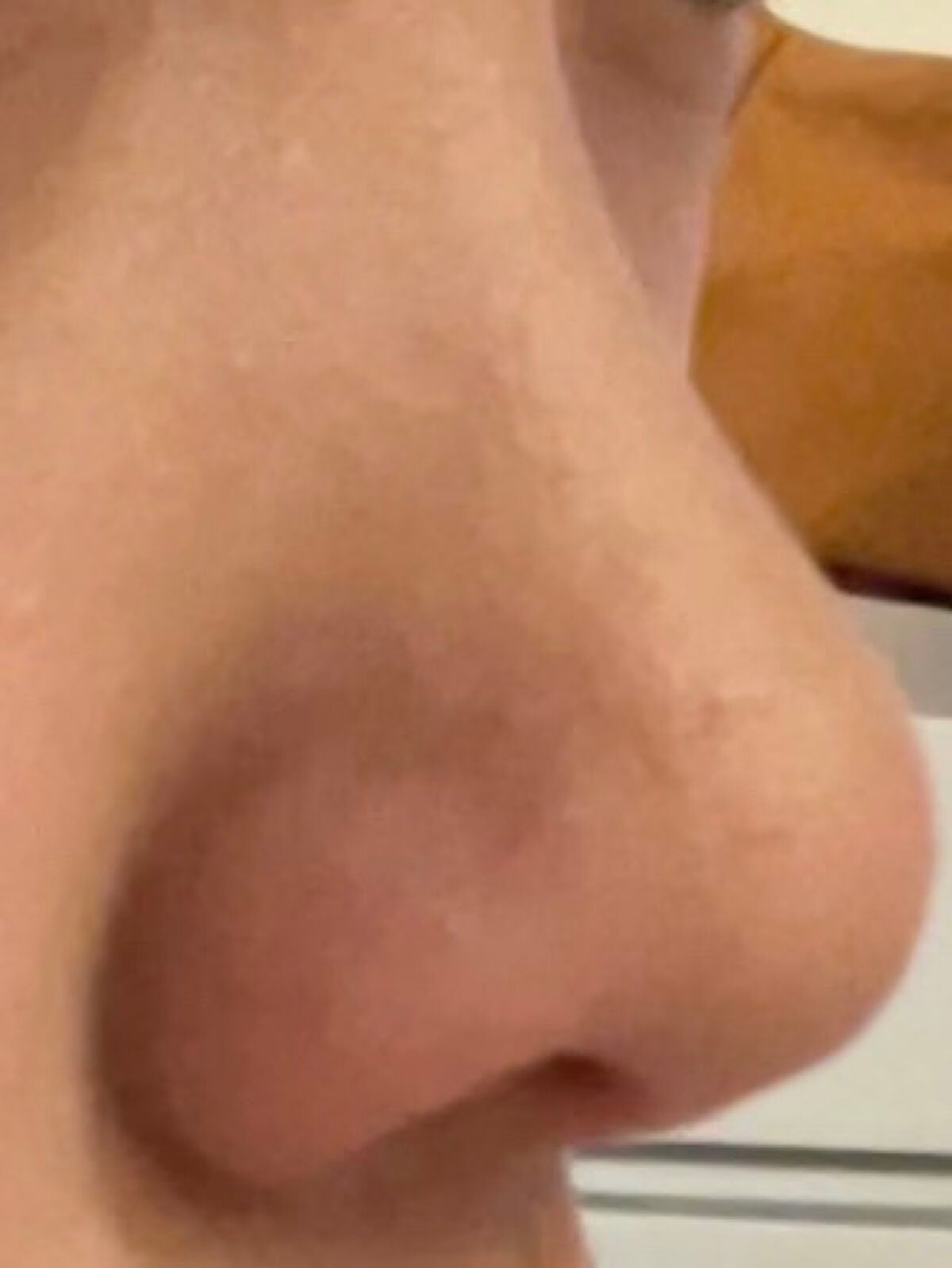 甘い on LIPS 「自分の鼻の形がわからないです教えてください#はじめての投稿..」(2枚目)