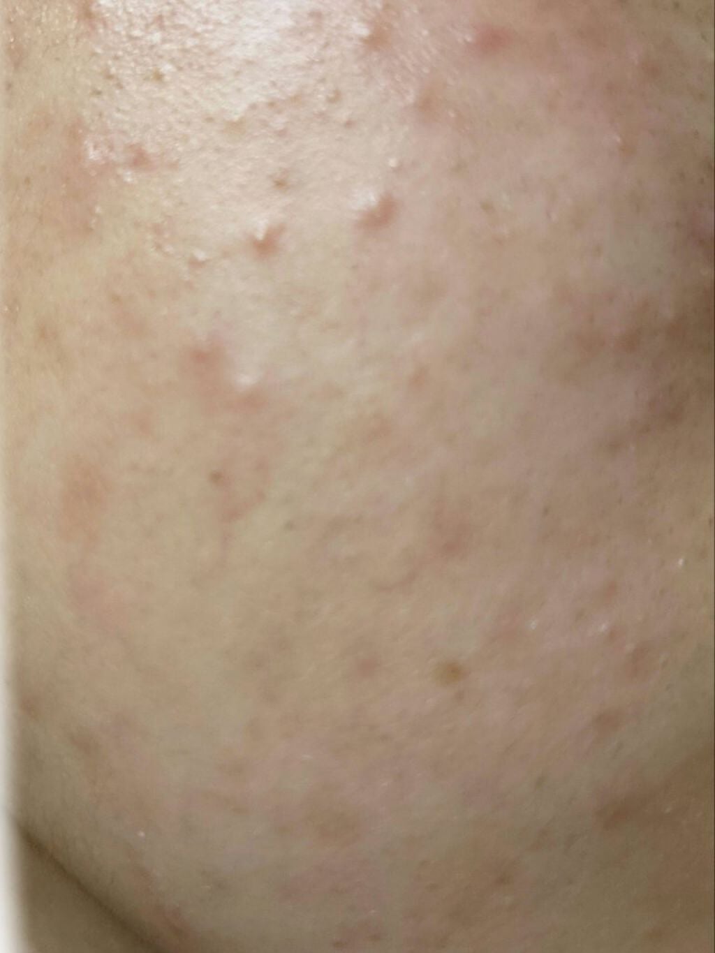 DHC はとむぎエキス/DHC/健康サプリメントを使ったクチコミ(4枚目)