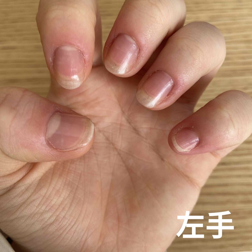 アロマキューティクルオイル/D-UP/ネイルオイル・トリートメントを使ったクチコミ（2枚目）