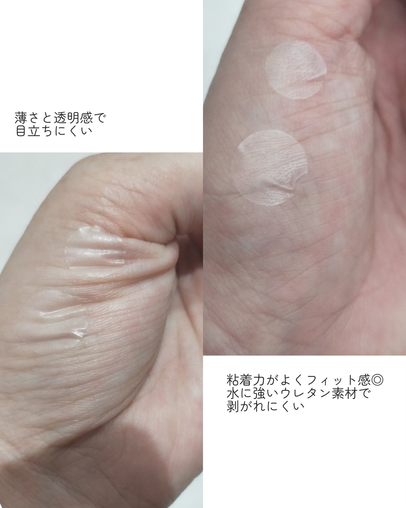 極薄透明パッチ nikipa!/金冠堂/にきびパッチを使ったクチコミ(3枚目)