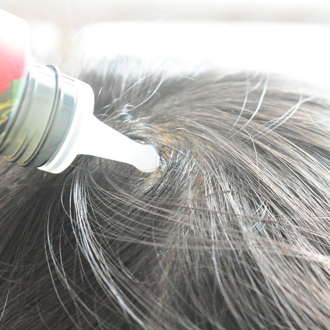 スカルプリッチ プロフェッショナル/日清食品/頭皮ローションを使ったクチコミ(6枚目)