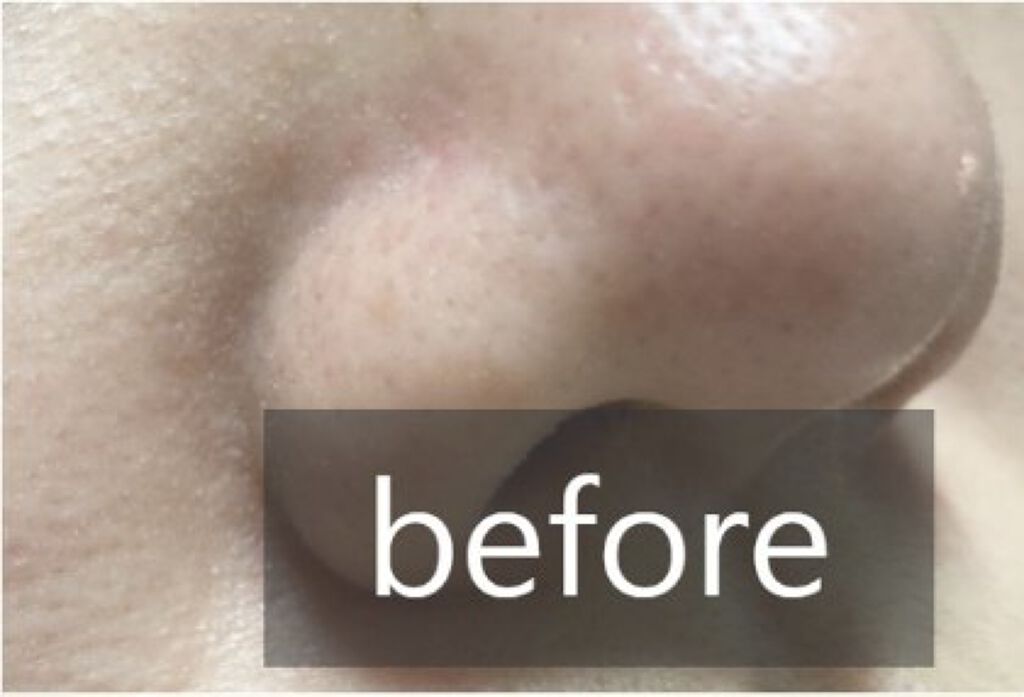 Cell Energy Liquid Face Cleanser/MORIQUENDI/クレンジングジェルを使ったクチコミ(3枚目)