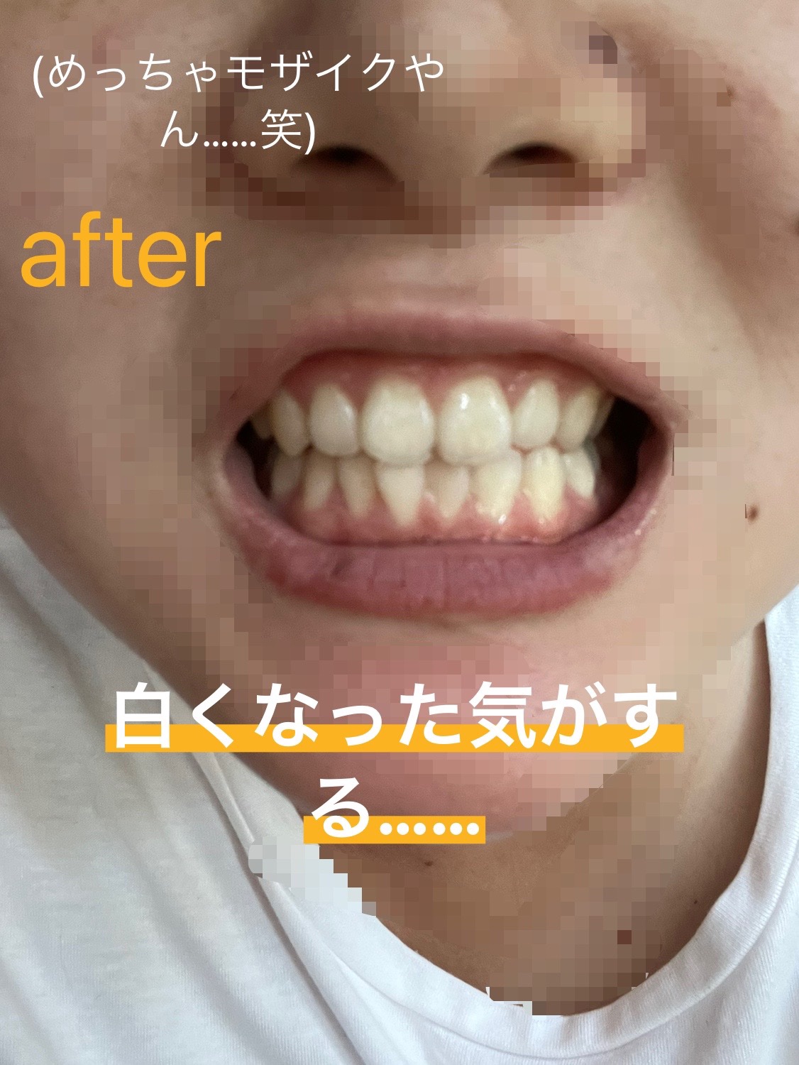 歯磨き堂 薬用ホワイトニングペースト プレミアム/歯磨き堂/歯磨き粉を使ったクチコミ（3枚目）