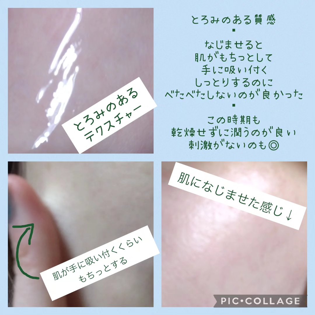 ジュービランス HSCコンセントレート/World is Mine/美容液を使ったクチコミ（3枚目）