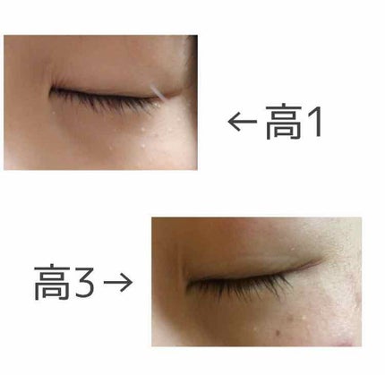 薬用 しみ 集中対策 美容液/メラノCC/美容液を使ったクチコミ(2枚目)