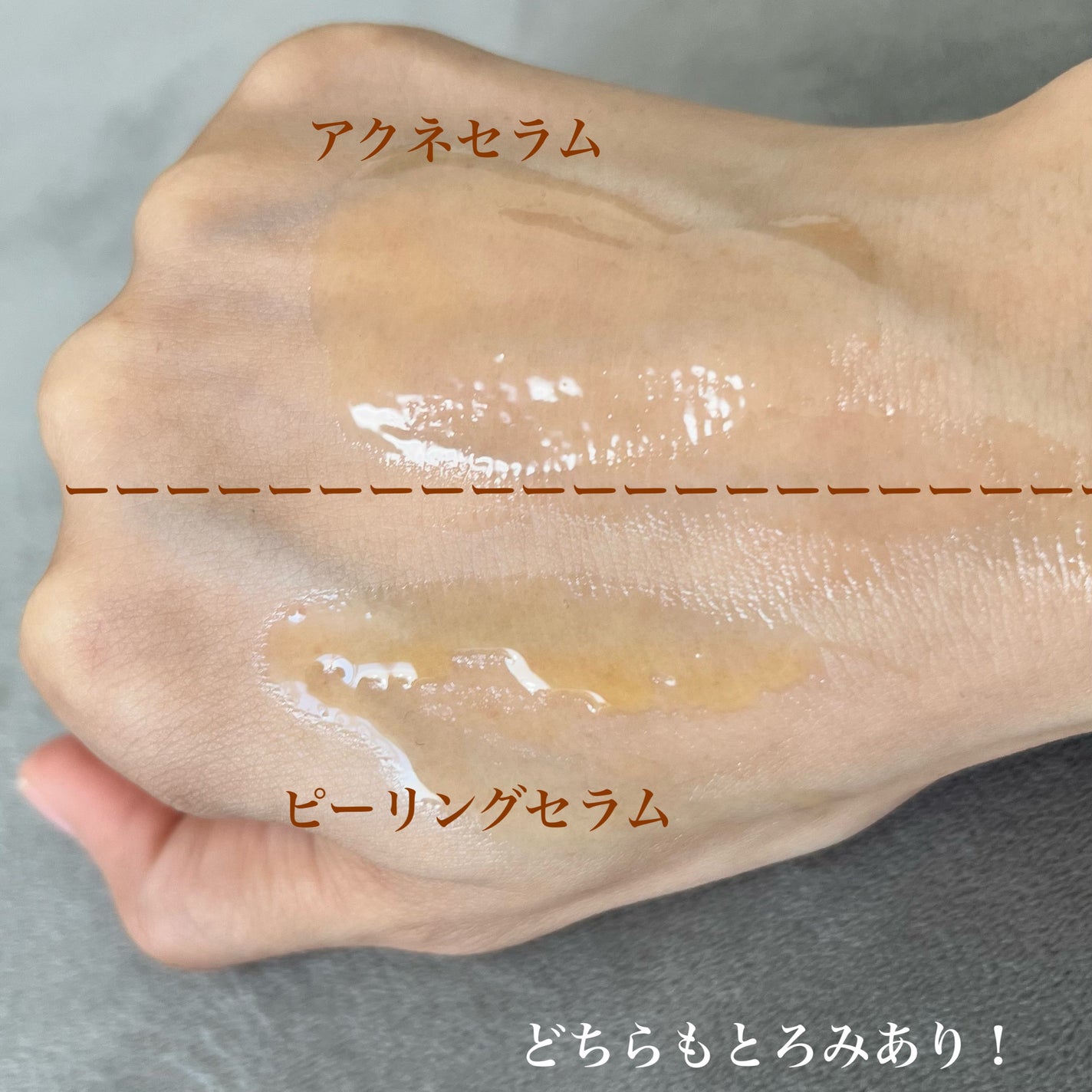 レッドアクネピーリングセラム/MEDICUBE/美容液を使ったクチコミ(5枚目)