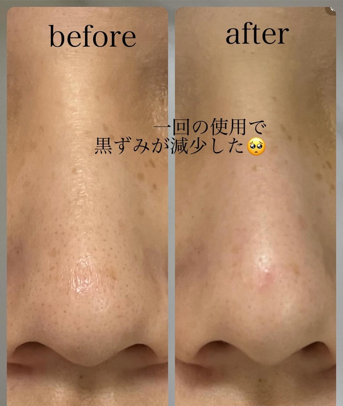 カロテンIPMP(TM) とろけるクレンジングバーム /APRILSKIN/クレンジングバームを使ったクチコミ(2枚目)