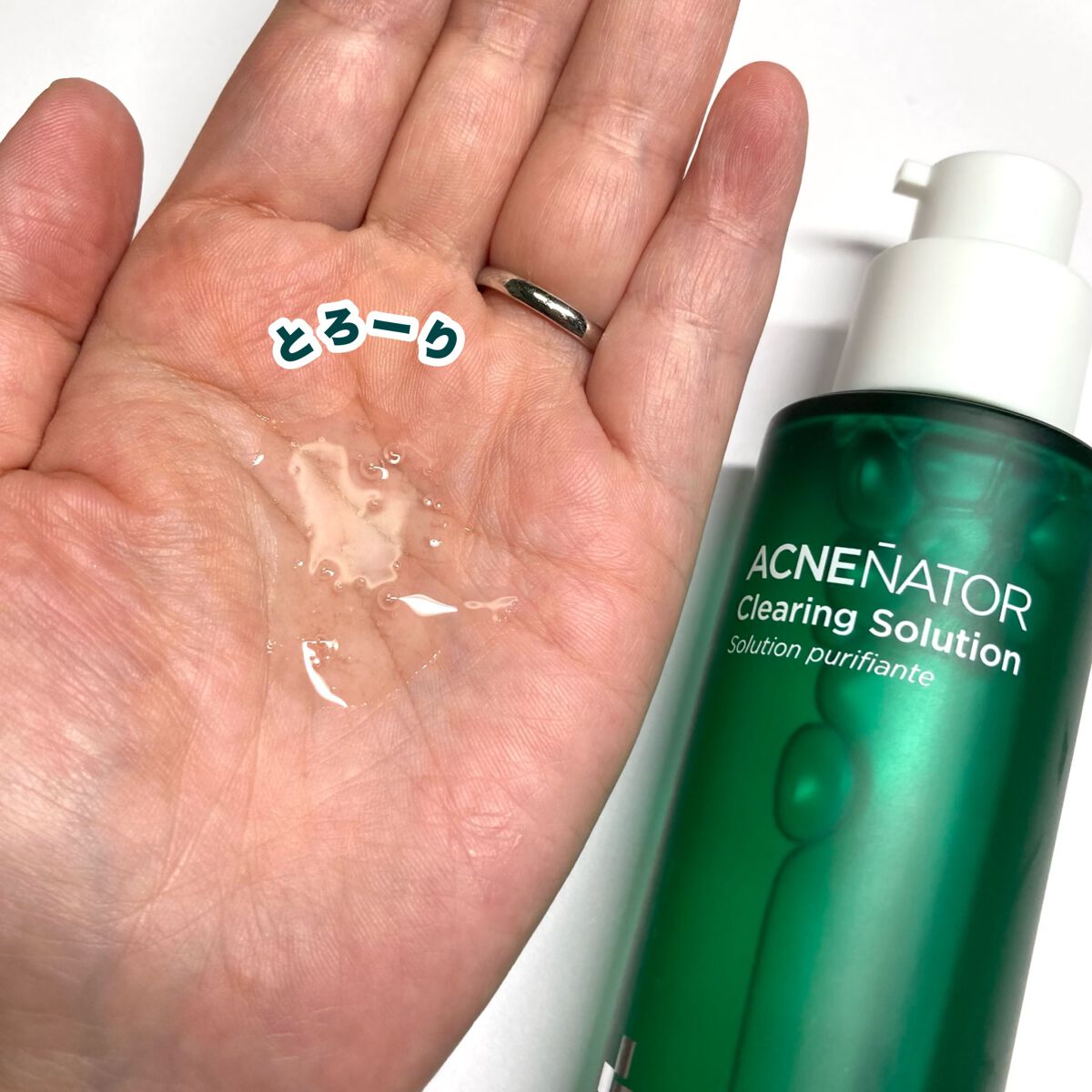 アクネネータークリアリングクレンジングフォーム/HOLIKA HOLIKA/化粧水を使ったクチコミ(6枚目)