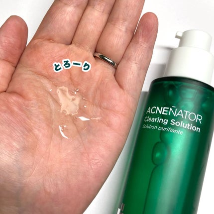 アクネネータークリアリングクレンジングフォーム/HOLIKA HOLIKA/化粧水を使ったクチコミ(6枚目)