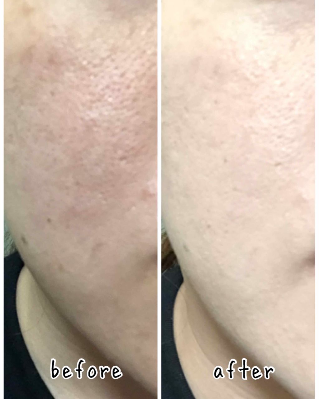 スーパーモイストクッションファンデーション/プレスカワジャパン/クッションファンデーションを使ったクチコミ(4枚目)