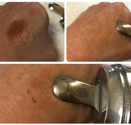 ダブルピーリングプレミアム/mysé(ミーゼ)/美顔器・マッサージを使ったクチコミ(4枚目)