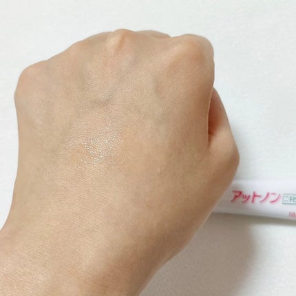 ニキビあとケアジェル/アットノン/その他スキンケアを使ったクチコミ(4枚目)